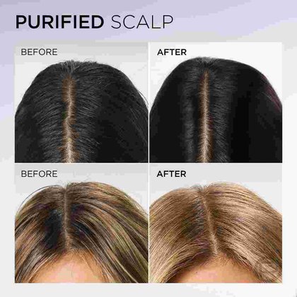 20251005 Oap Elvive Hyaluron Pure Conditioner Before After ATF04 Na Dmi Ecomm Img 2000x2000
