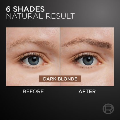 Dark Blonde 3