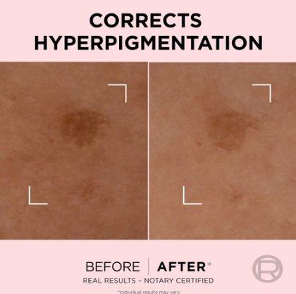 Serum Age Perfect Golden Spot Correcting